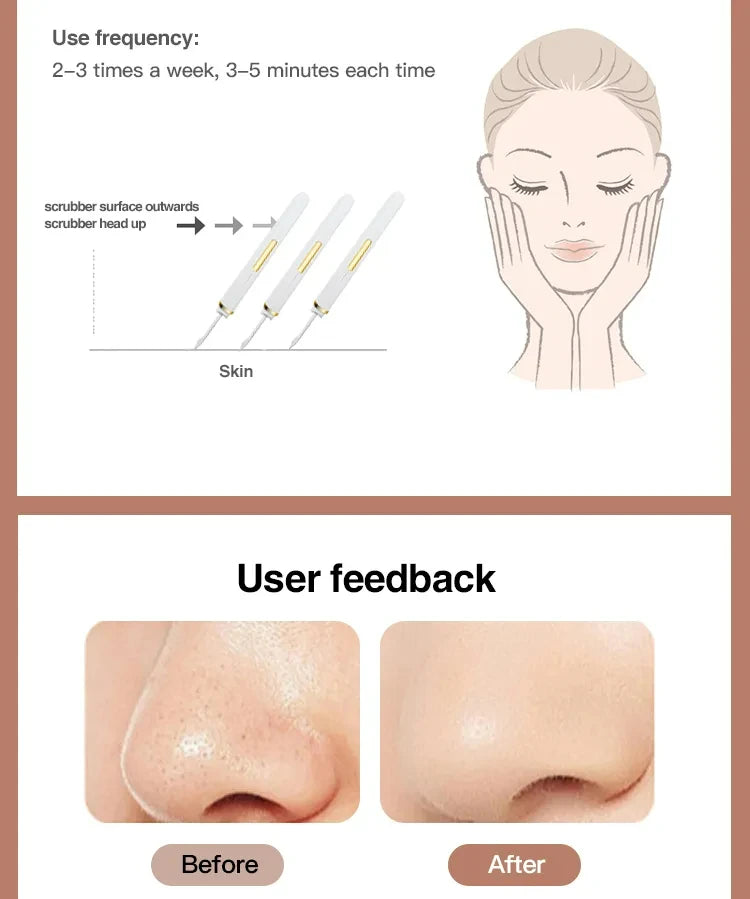Ultrasonic Skin Scrubber Vibration Face Spatula Blackhead Remover Shovel Clean Cavitation Peeling Facial Lifting skin care