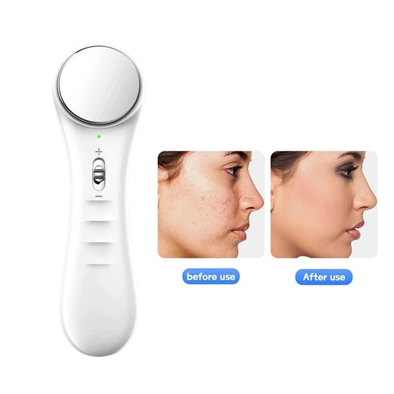 Facial Mesotherapy Electroporation RF&EMS Radio Frequency Photon Face Lifting Tighten Wrinkle Removal machine