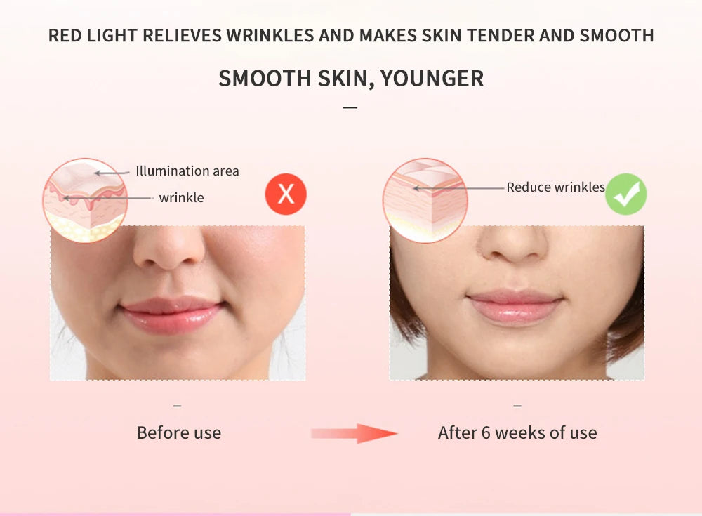 Facial Mesotherapy Electroporation RF&EMS Radio Frequency Photon Face Lifting Tighten Wrinkle Removal machine